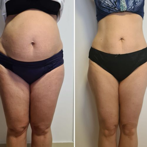 PHOTO-2025-04-25-17-17-24