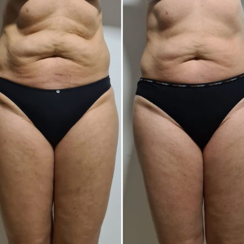 PHOTO-2025-04-25-17-18-32