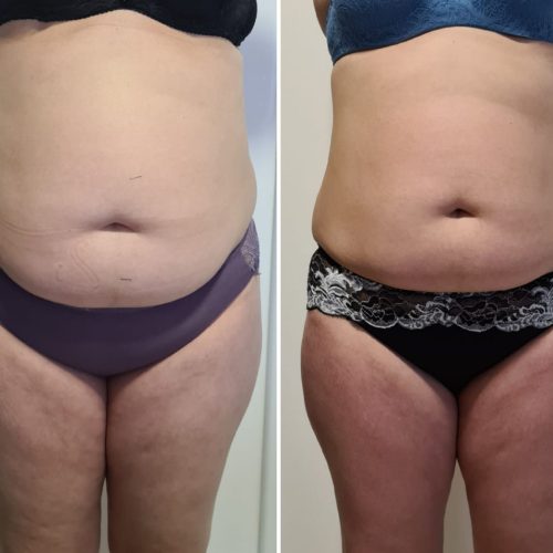 PHOTO-2025-04-25-17-19-01