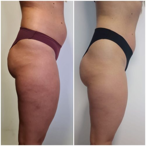 PHOTO-2025-04-25-17-20-07