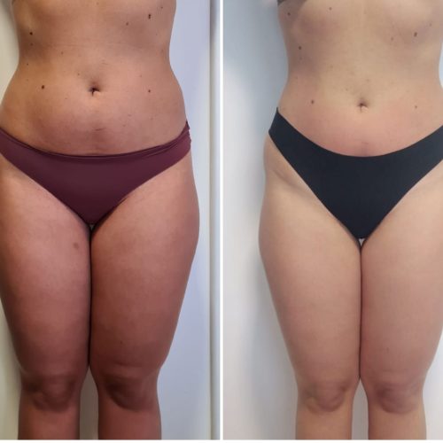 PHOTO-2025-04-25-17-20-17